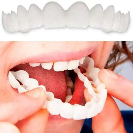 SmilePro 馃Ψ - Carillas Dentales Ajustables De Resina + ESTUCHE REGALO - 隆脷ltimas unidades!